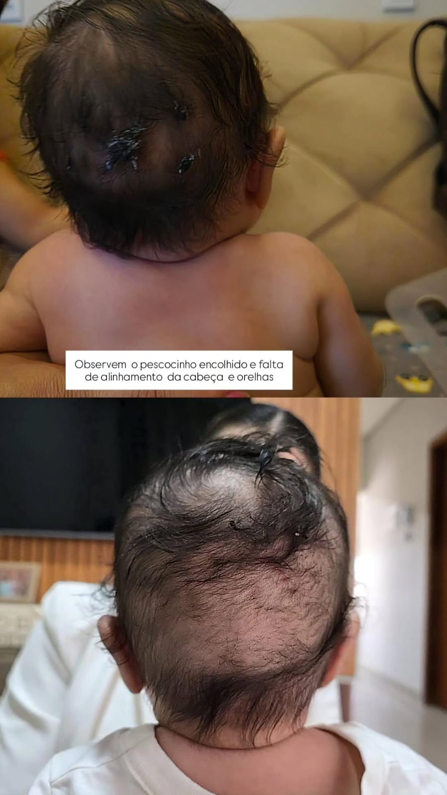 Colagem antes/depois de torcicolo com fundo rosa